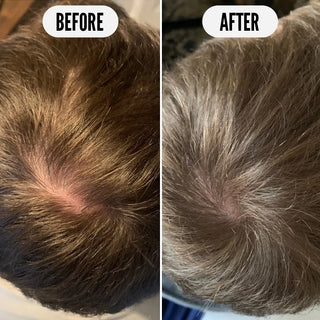 Hair Thickening Get Set Grow Starter Bundle